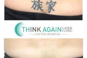 Think Again Laser Clinic - Brisbane